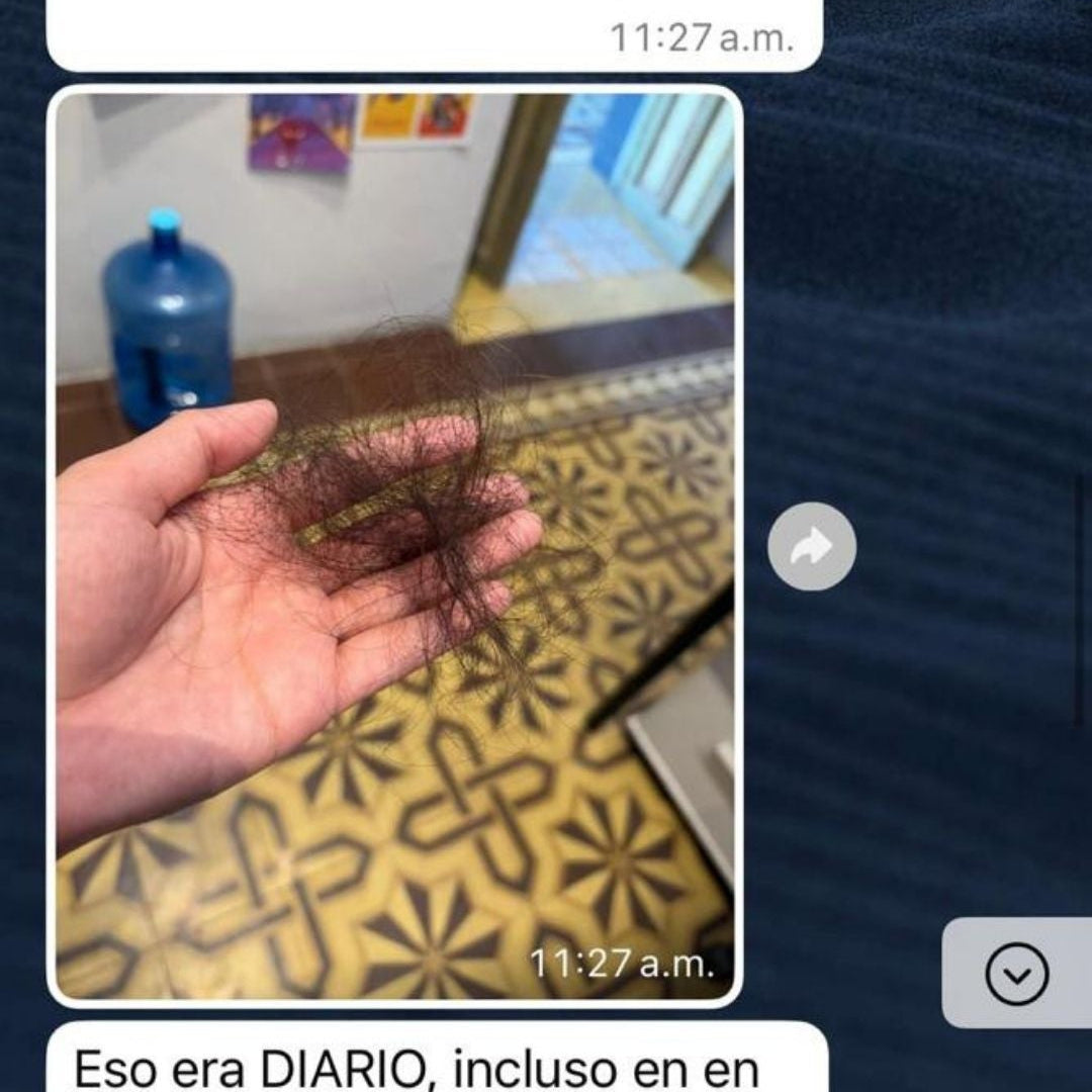 Caída de cabello